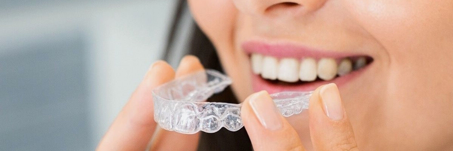 Clear aligners in Encino CA at Finer Smiles Dental