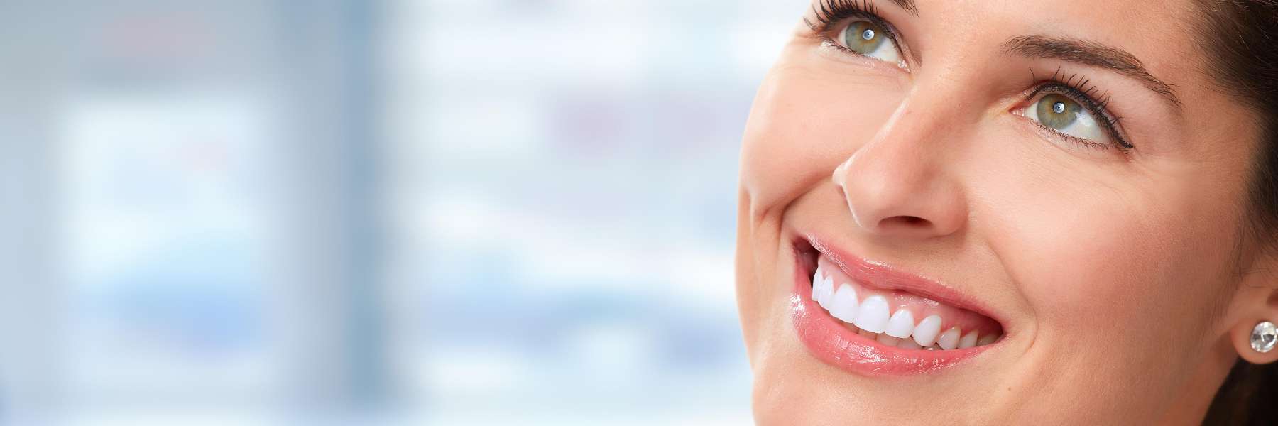 Veneers | Dentist